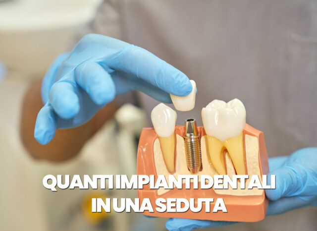 quanti impianti si possono mettere in una seduta