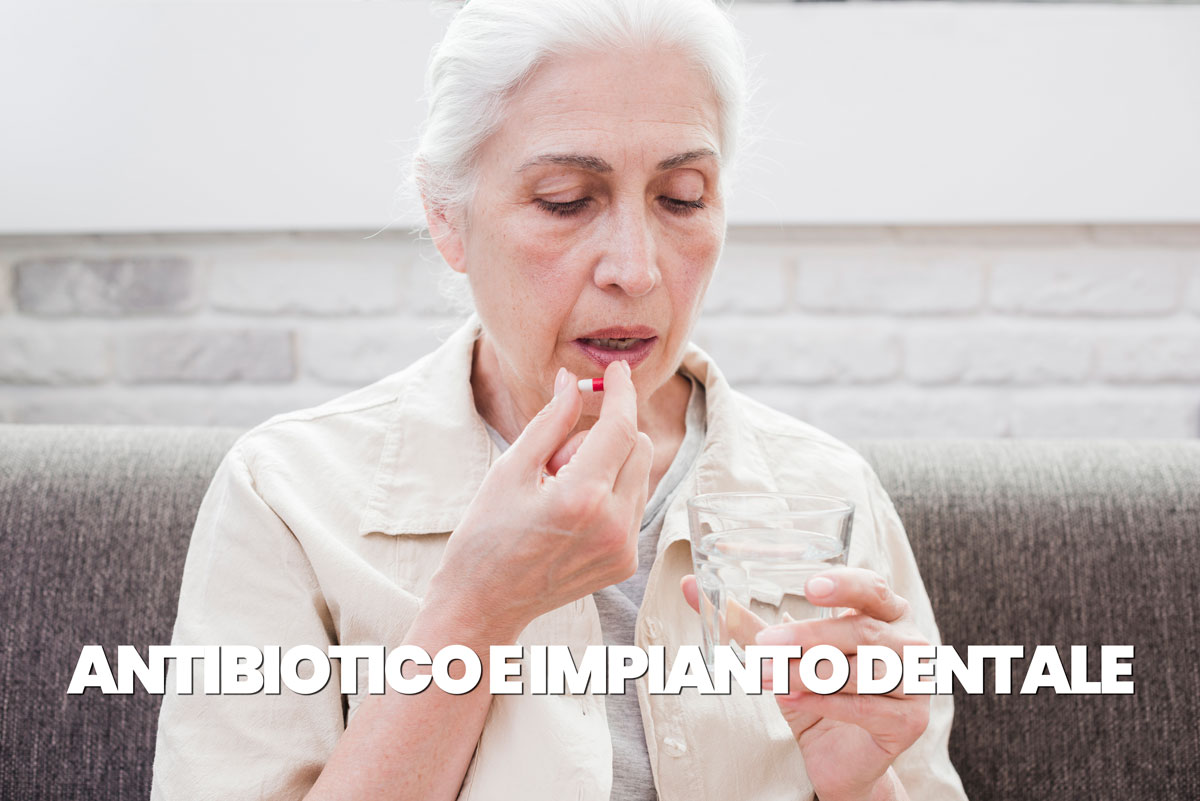 antibiotico e impianto dentale