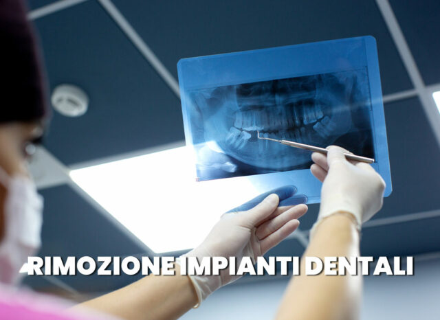 rimozione impianti dentali