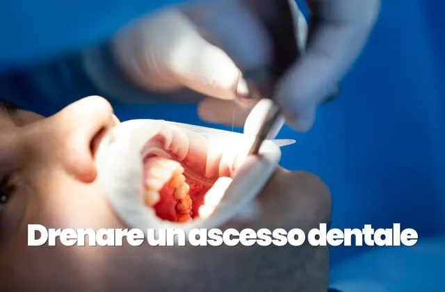 drenare ascesso dentale