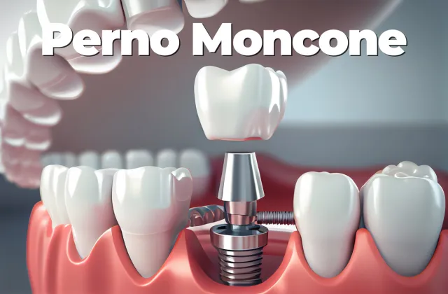 perno moncone