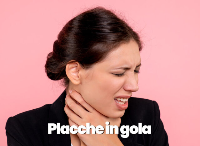 placche in gola