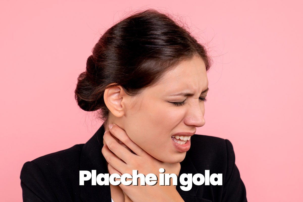 placche in gola