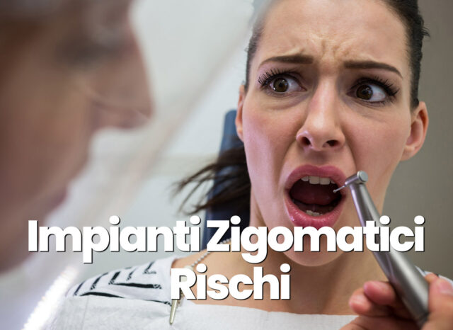 impianti zigomatici rischi