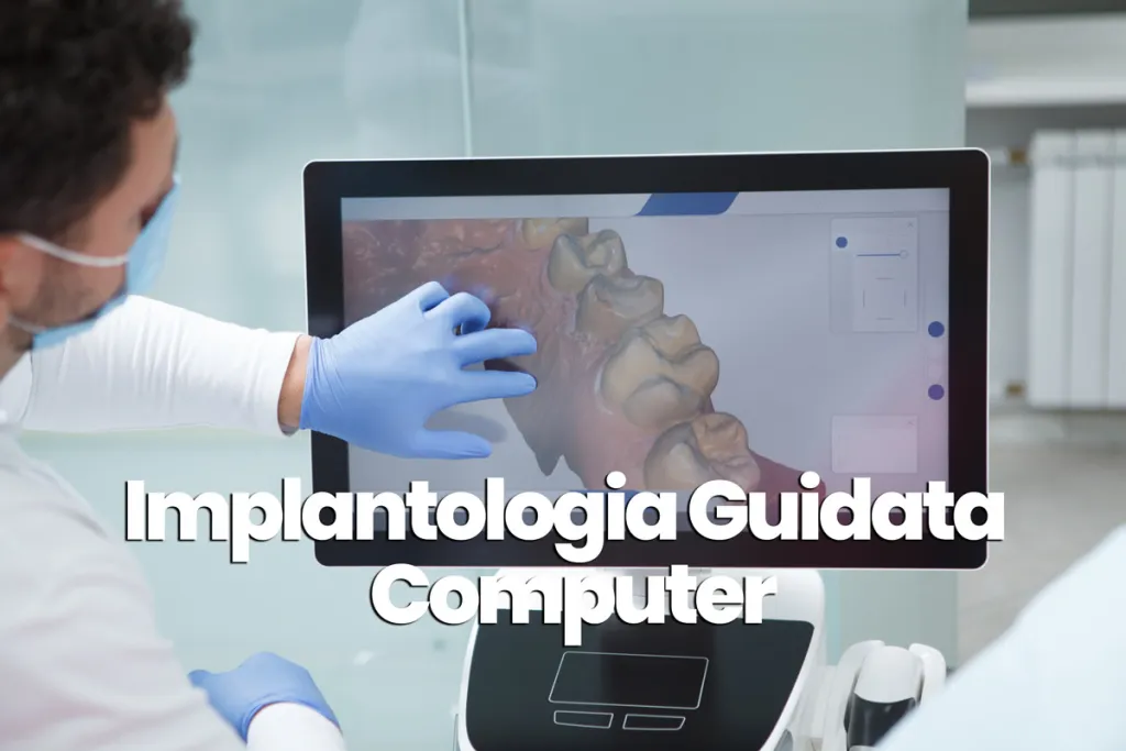 implantologia guidata a computer