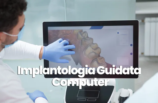 implantologia guidata a computer