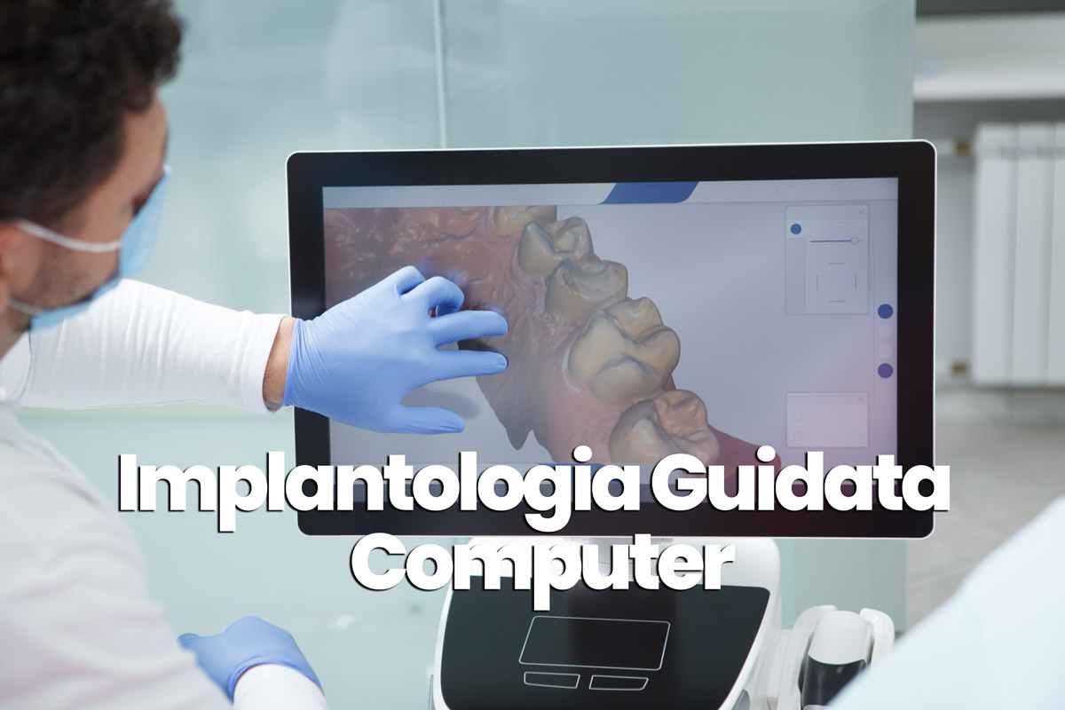 implantologia guidata a computer
