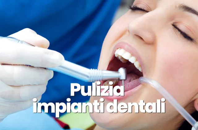 pulizia impianti dentali