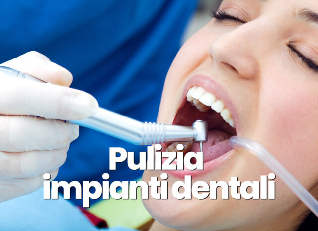 pulizia impianti dentali